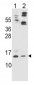 ApoC2 Antibody (Center)