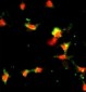 CCL2 Antibody (CT)