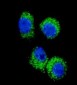 CCL2 Antibody (CT)
