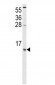 CCL2 Antibody (CT)