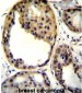 AKT1 (Thr308) Antibody