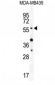 AKT1 (Thr308) Antibody