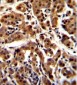 AKT1 (T450) Antibody (CT)