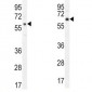 AKT1 (T450) Antibody (CT)