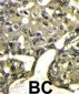 AKT1 Antibody (NT)
