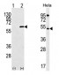 AKT1 Antibody (NT)