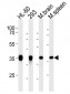 Aldolase C (ALDOC) Antibody (CT) Clone # 859CT9.5.3