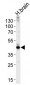 Aldolase C (ALDOC) Antibody (NT)