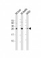 CDX1 Antibody (C-term)