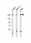 CAD Antibody (Center)