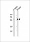 TGFBR2 Antibody (N-term)