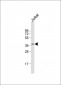 LEF1 Antibody (N-term)