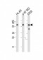 IL1RL2 Antibody (Center)