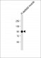 PYGM Antibody (C-term)