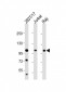 REST Antibody (Center)
