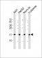 RPL22 Antibody(C-term)