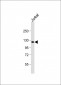 PRDM16 Antibody (Center)