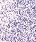 BCL6 Antibody (Center)