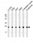 UQCRFS1P1 Antibody (Center)