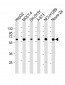 CHRNA4 Antibody (N-Term)