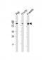 ERVK-7 Antibody (N-Term)
