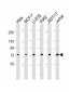 NDC80 Antibody (C-Term)