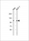 VLDLR Antibody (C-Term)