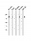 SYNJ1 Antibody (C-term)