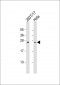 NQO2 Antibody (N-Term)