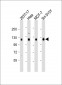 DLG1 Antibody (Center)