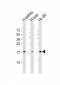 FHIT Antibody (N-Term)