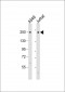 COL11A1 Antibody (N-Term)