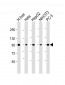 PYGL Antibody (C-Term)