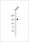 TMF1 Antibody (Center)
