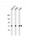 MYBL2 Antibody (C-Term)