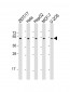 PLAGL1 Antibody (N-Term)