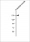 MYH4 Antibody (N-Term)