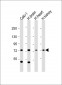 RNF139 Antibody (C-Term)