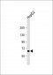 PICALM Antibody (C-Term)