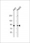 E2F8 Antibody (C-Term)