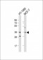 Cyclin D1 Antibody (S90)