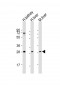 SIRT3 Antibody (C-term)