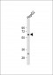 Glypican 3 (GPC3) Antibody (N-term)