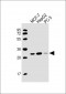 PSME2 Antibody (Center)