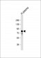 VTN Antibody (N-term)