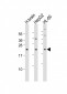 PNOC Antibody (Center)