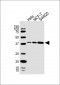 HPN Antibody (Center)