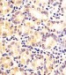 FN3KRP Antibody (N-Term)