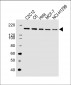 ROCK2 Antibody (C-term)