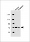 SLC5A4 Antibody (C-term)
